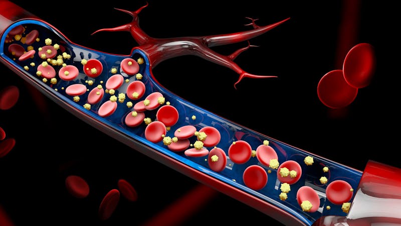 Colesterol: ¿imprescindible para la vida o causa de muerte? Colesterol: ¿imprescindible para la vida o causa de muerte?