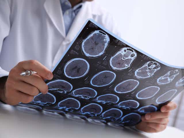 Cropped image of a person in a white coat looking at brain scans