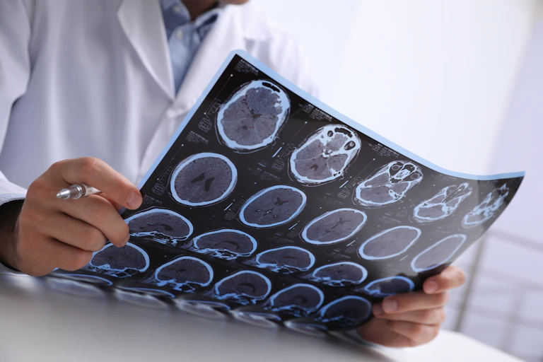 Cropped image of a person in a white coat looking at brain scans