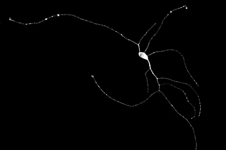 neurone au microscope