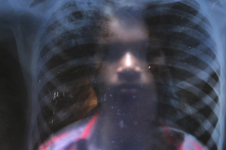 Man looking at chest X-ray