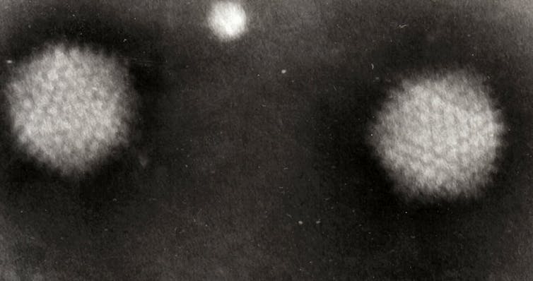 Transmission electron micrograph of two adenovirus particles.