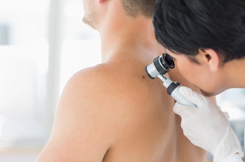 The doctor says my mole is a melanoma. What happens next?