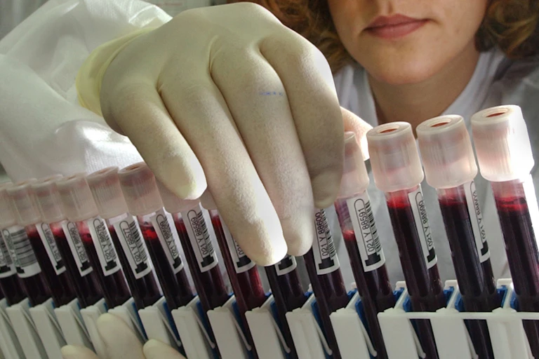 globed technician handles vials of blood