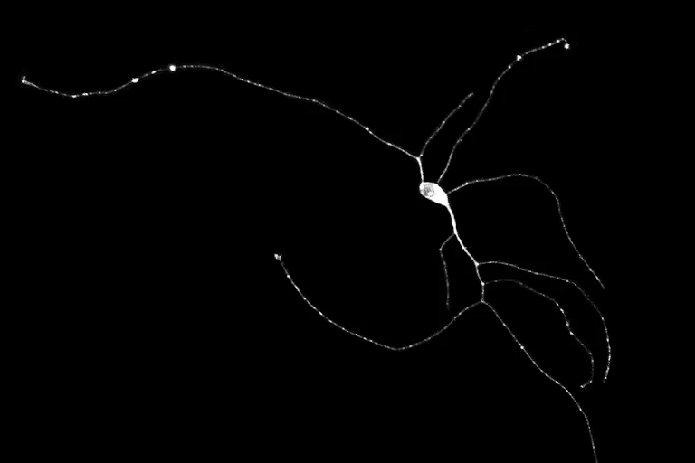 microscope image of a neuron