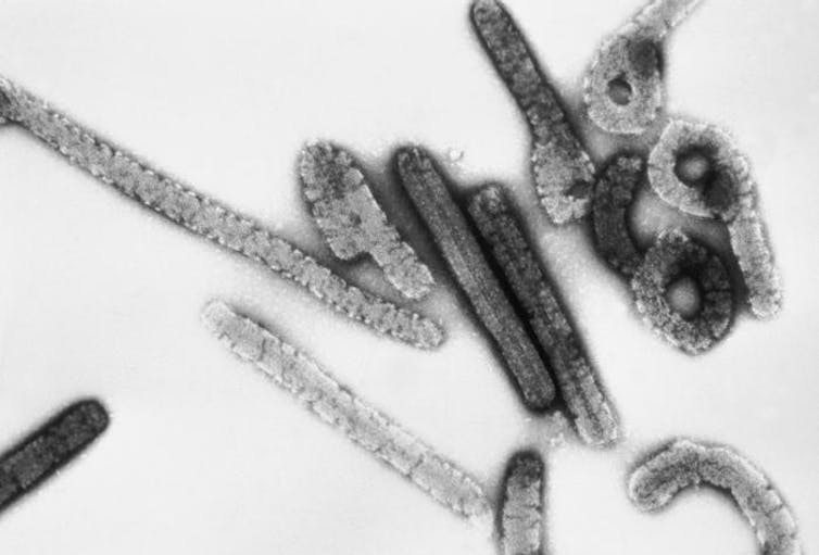 Dentro da familia Filoviridae existen varios xéneros: Ébola (especies Zaire, Sudan, Reston, Tai Forest, Bundibugyo ebolavirus), Marburg (especie Marburg marburgvirus), Cuevavirus (especie Llobiu cuevavirus), entre outros. CDC/Dr. Erskine Palmer, Russel Regnery, Ph. D., CC BY