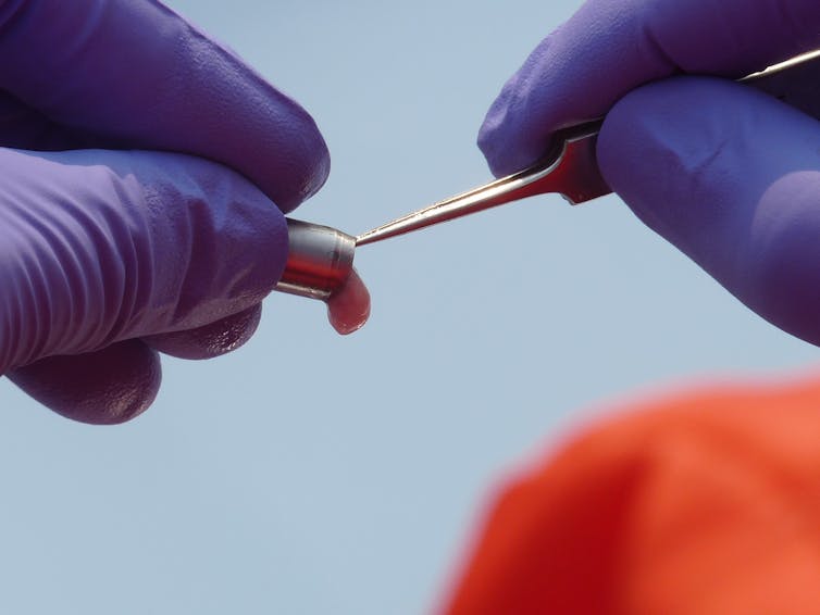 Close up with two gloved hands removing a tissue sample from a small container using forceps.