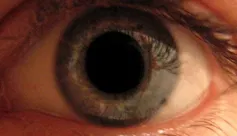 Gif montrant la contraction-dilatation d’une pupille sous l’effet d’une variation de la luminosité