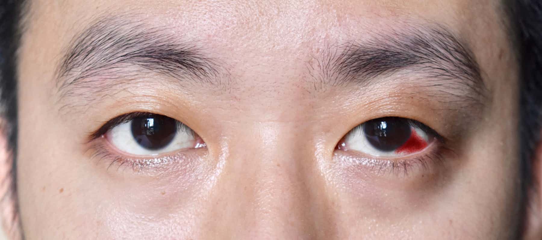 Ce que vos yeux révèlent de votre santé