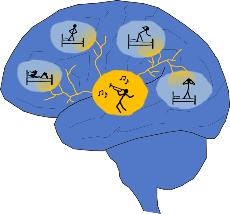 A cartoon image depicting the effect local wakefulness can have on the sleeping brain.