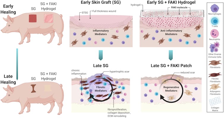 Diagram of pigs with skin grafts treated with or without drug (FAKI hydrogel), where skin grafts with drug had reduced inflammation and scar formation.
