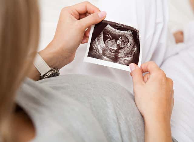 Cropped image of a woman holding an ultrasound image