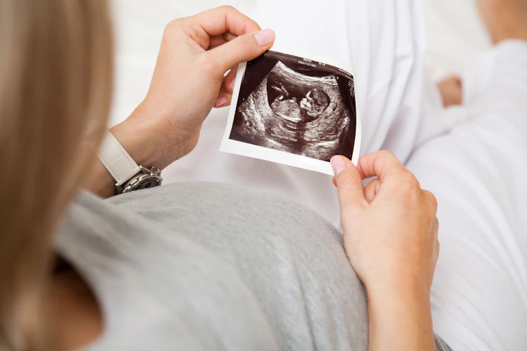 Cropped image of a woman holding an ultrasound image