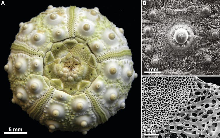 Skeleton of a current sea urchin and details of one of its calcite plates. On the right, the microstructure that forms its skeleton, known as a stereome.