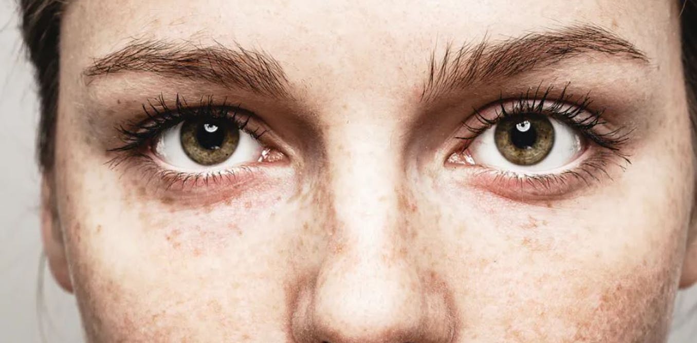 Dari mata turun ke hati: apa yang diungkapkan mata tentang kesehatan Anda