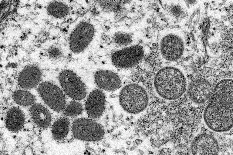 Micrographie électronique de particules virales de monkeypox