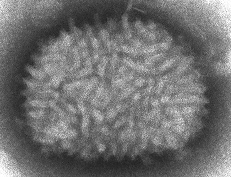 Vaccinia virus.