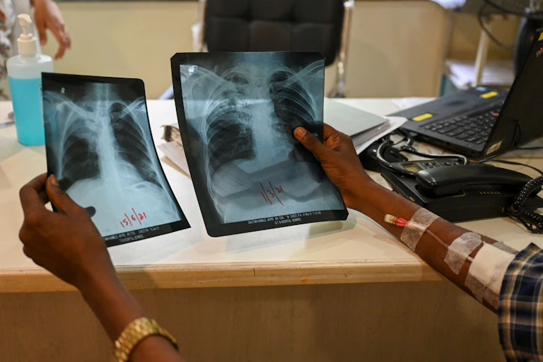 Man holding chest x-rays.