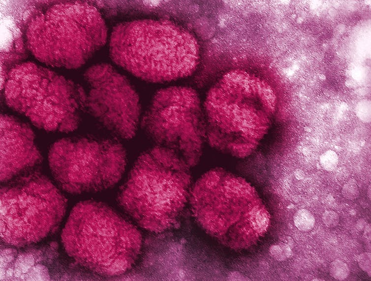 Smallpox virus.