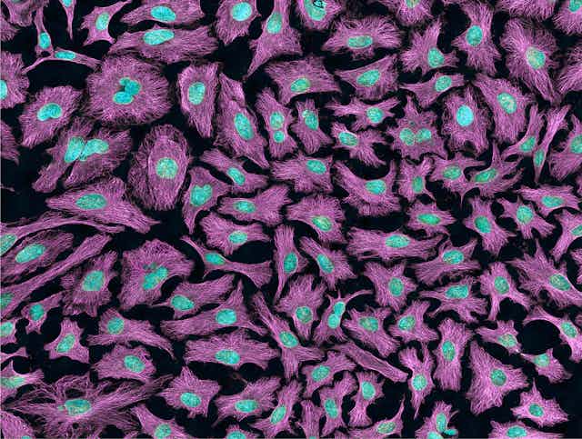 HeLa cells stained magenta with cyan nuclei