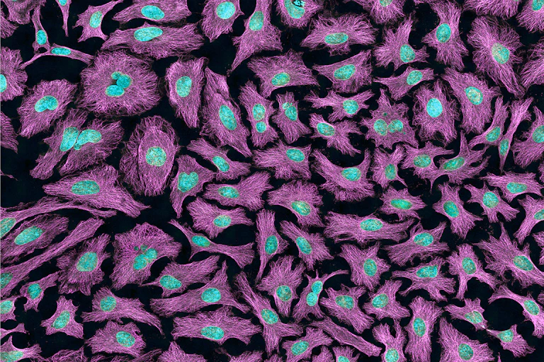 HeLa cells stained magenta with cyan nuclei