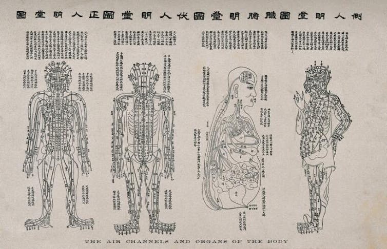 chinese medicine chart with lines through body