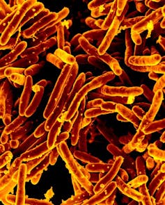 Inhaled vaccine for COVID-19: The pandemic accelerated decades of research leading to jab-free vaccine now in human testing Inhaled vaccine for COVID-19: The pandemic accelerated decades of research leading to jab-free vaccine now in human testing
