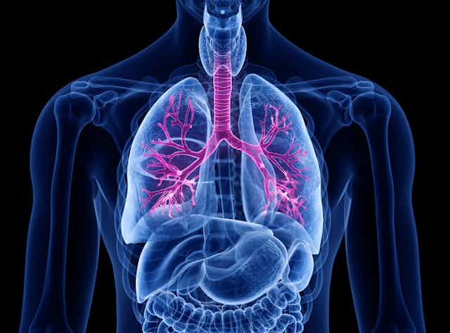 Illustration of lung airways showing airways in pink and organs in blue against a black background