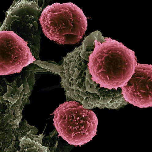 'Masked' cancer drug stealthily trains immune system to kill tumors while sparing healthy tissues, reducing treatment side effects