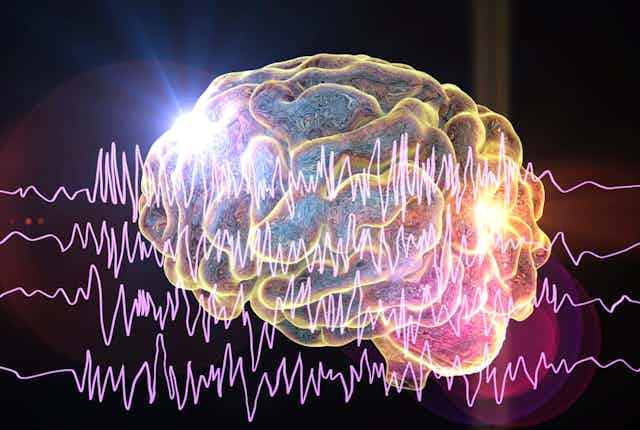 Cerveau et encéphalographie chez un patient épileptique pendant une crise