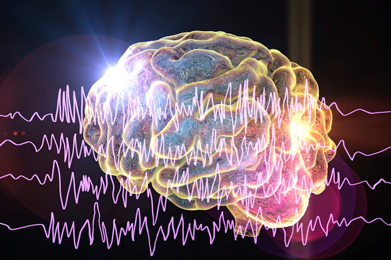 Cerveau et encéphalographie chez un patient épileptique pendant une crise