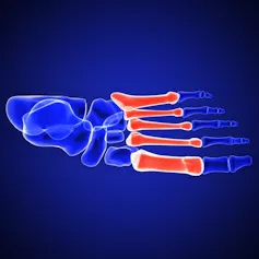 Bones of the feet, showing metatarsals
