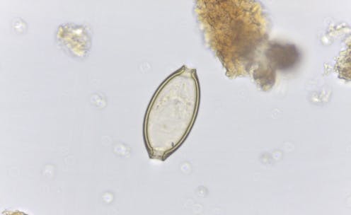 Paleoparasitología: una mirada a la antigüedad a través del microscopio Paleoparasitología: una mirada a la antigüedad a través del microscopio