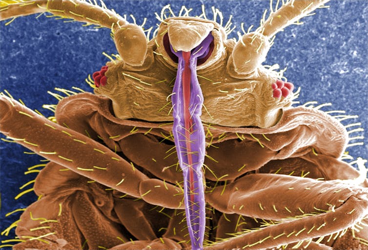 closeup of the front underside of a brown insect