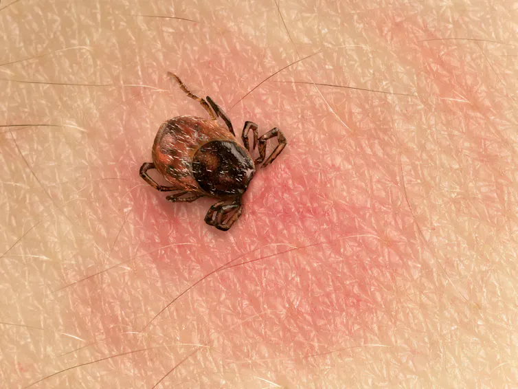 Por qué están aumentando los casos de la enfermedad de Lyme en España, Europa y EE. UU 7 file 20220603 14 jmlqoe.jpg?ixlib=rb 1.1
