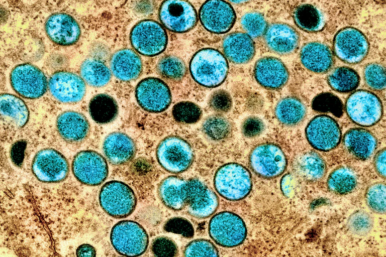 Blue and black circles on a speckled beige background