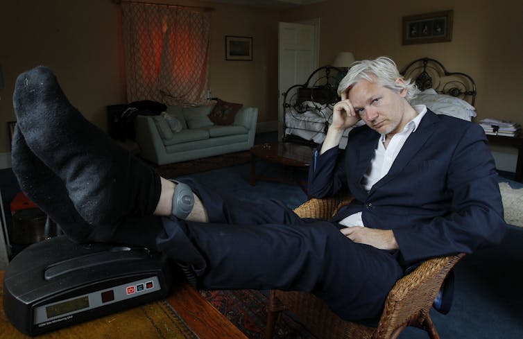 Assange displaying his ankle security tag in 2011