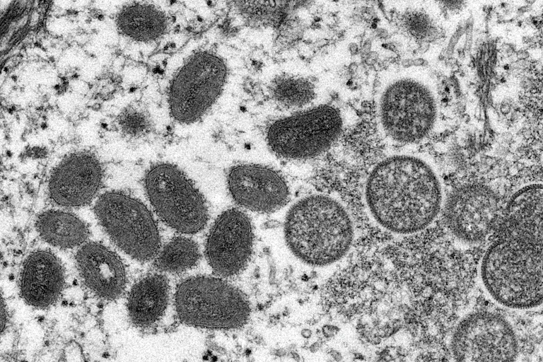 Electron micrograph of monkeypox virus particles