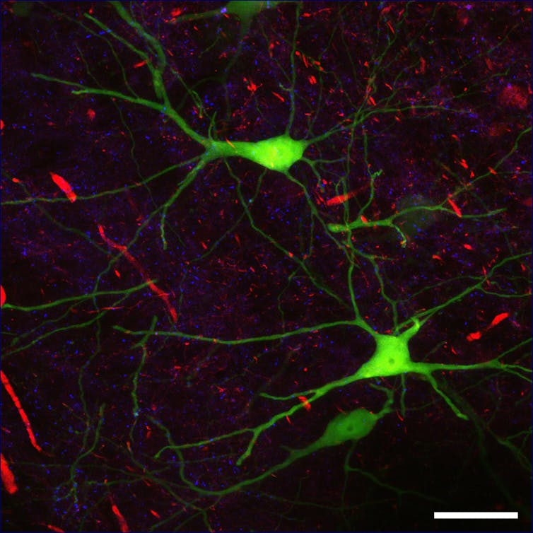 Image of different types of synapses in a mouse brain slice.