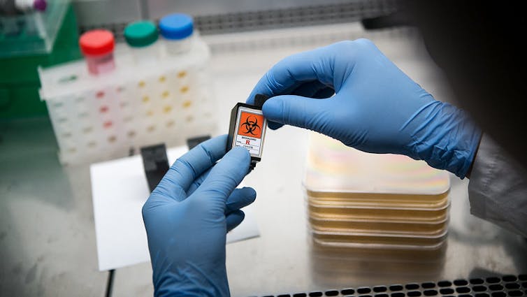 Manos enguantadas sosteniendo una muestra de riesgo biológico en el laboratorio