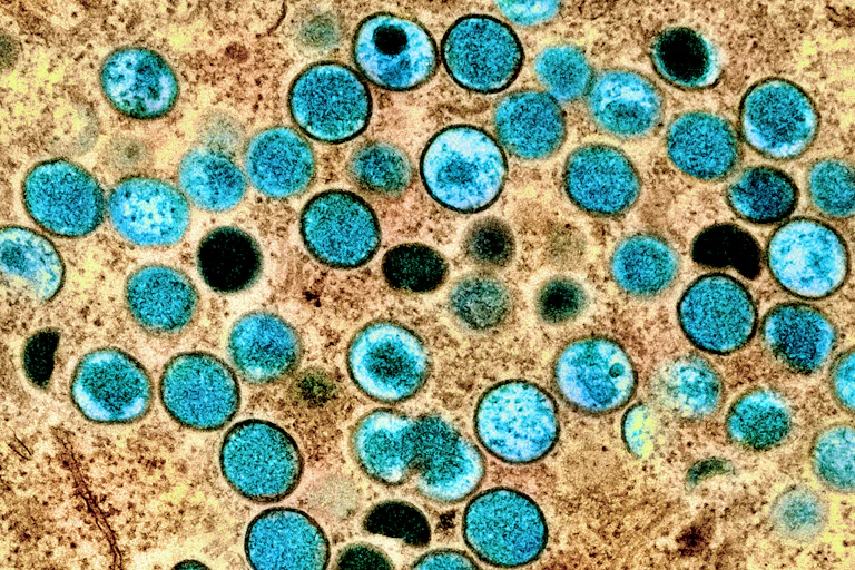 Cercles bleus et noirs sur un fond beige moucheté