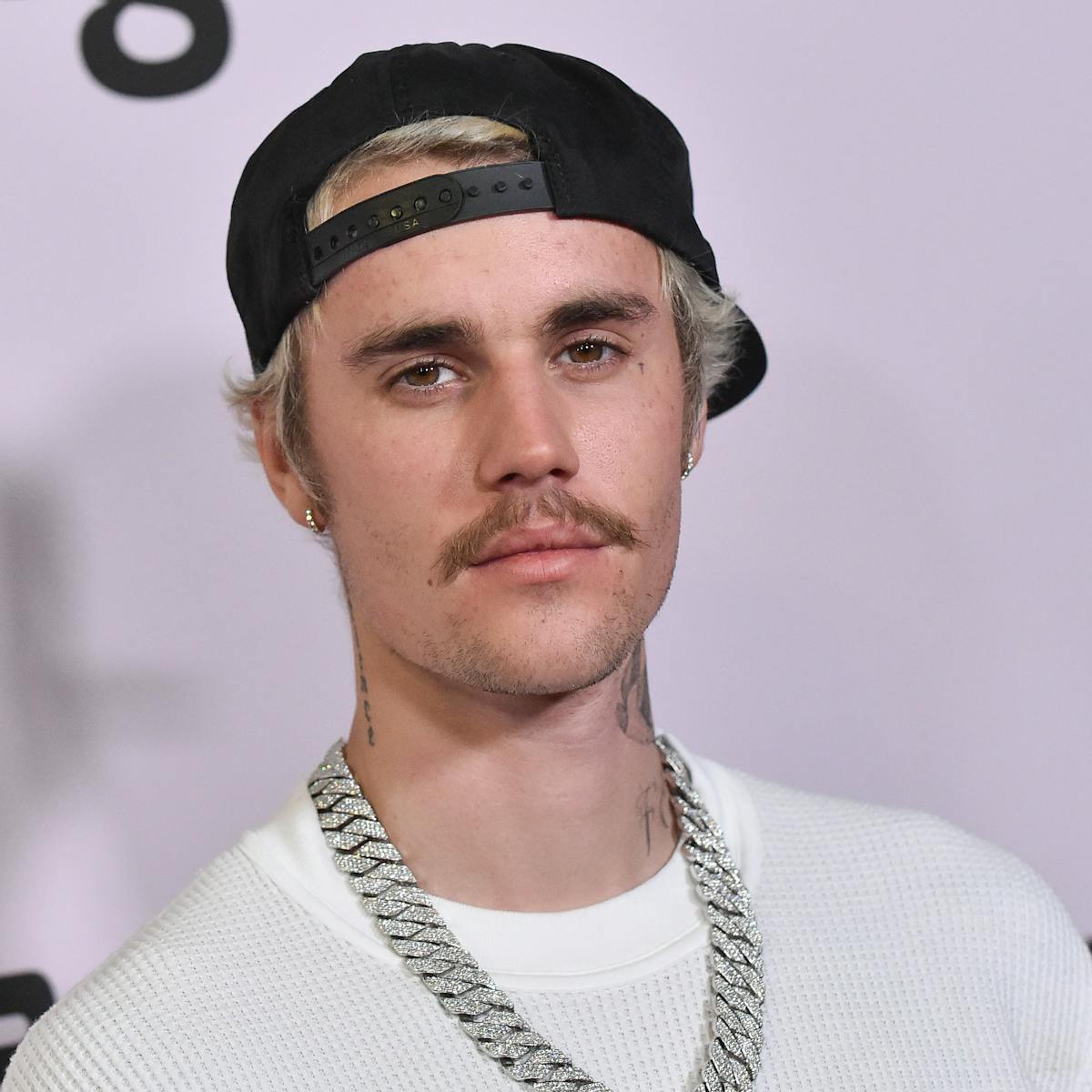 Justin Bieber: What Is Ramsay Hunt Syndrome, The Condition Affecting The  Singer?