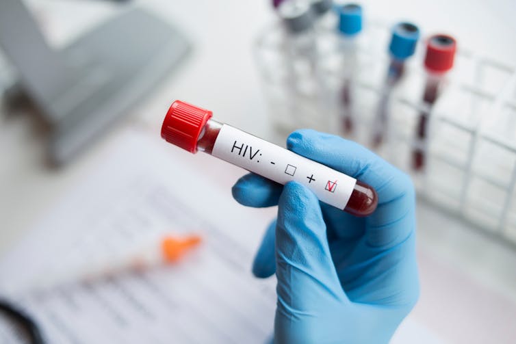 A gloved hand holds a vial that suggests a positive HIV result.