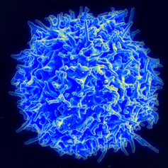 Scanning electron microscope image of a human T cell