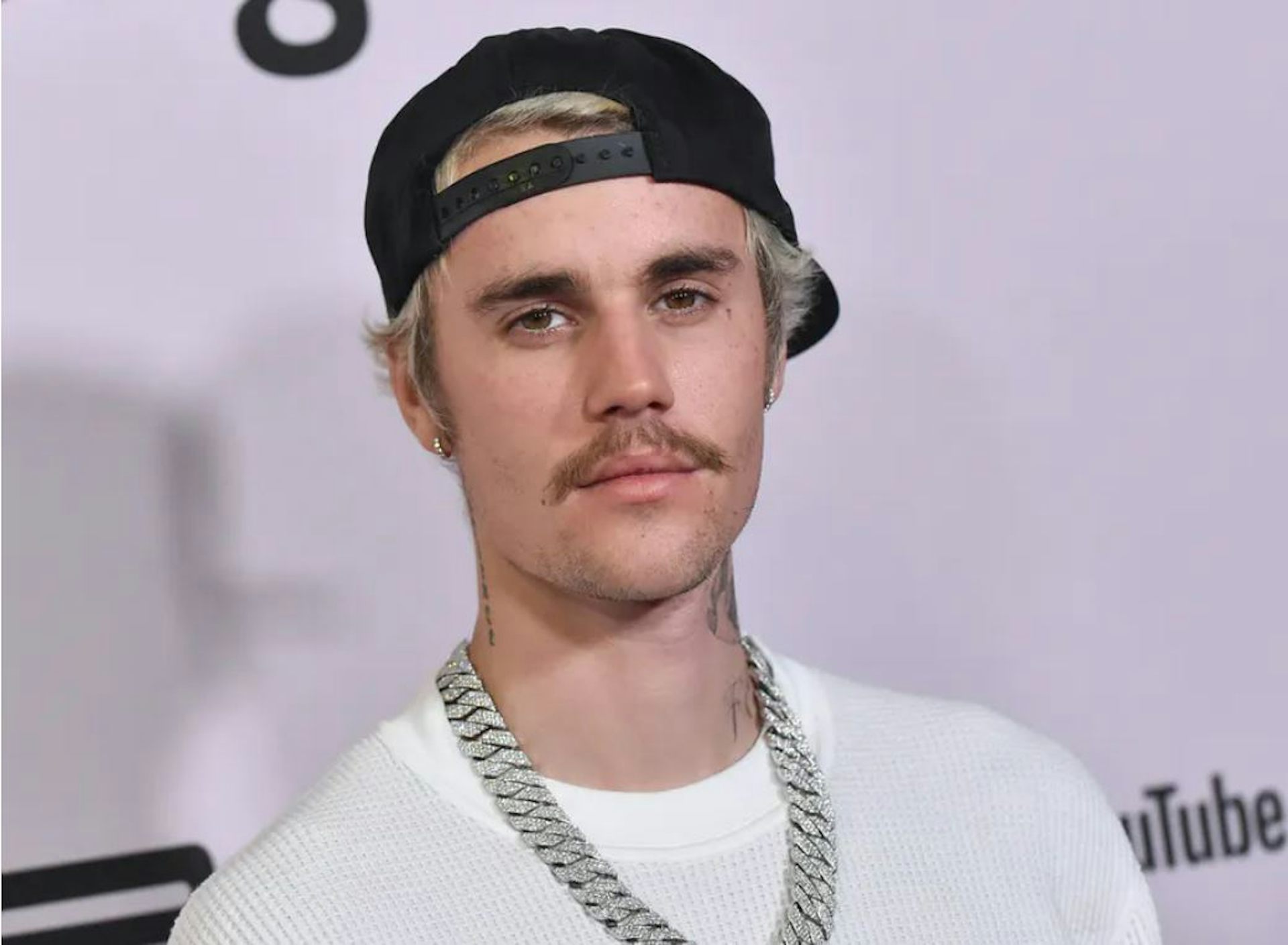 Separuh wajah Justin Bieber lumpuh karena sindrom Ramsay Hunt. Apa itu?