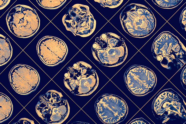 Images of brain scans.