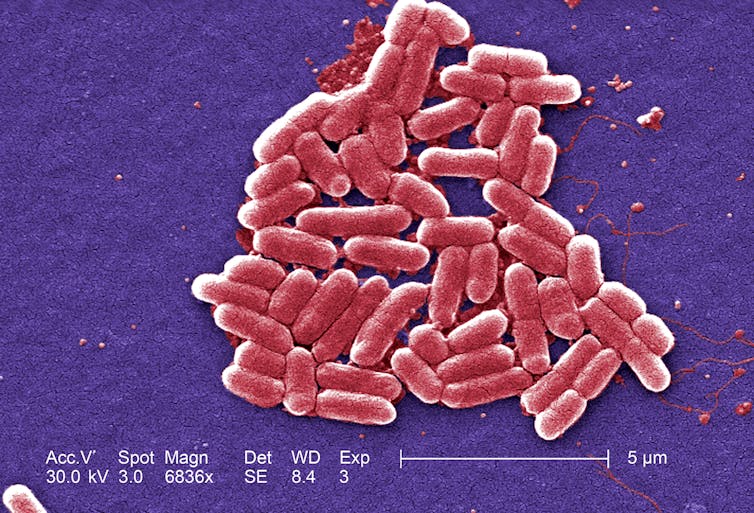Vue en microscopie d’un paquet de E. coli (en forme de bâtonnet allongé) pathogènes