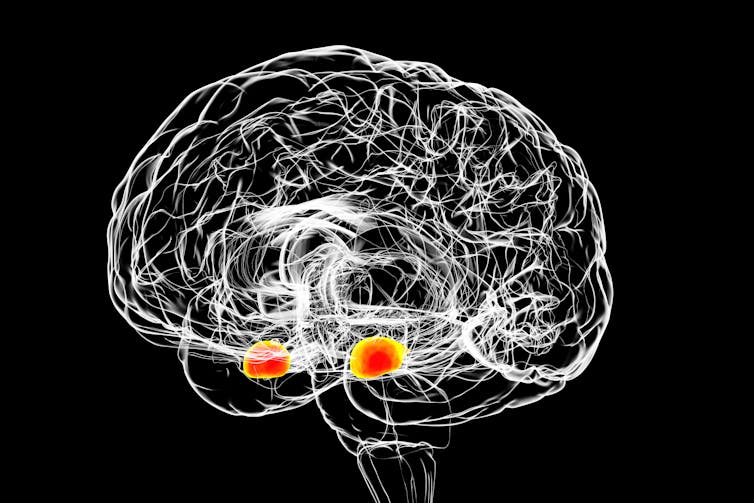 outline of brain with two small red dots highlighted