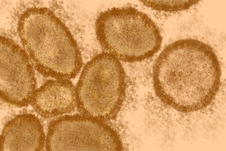 Monkeypox virus