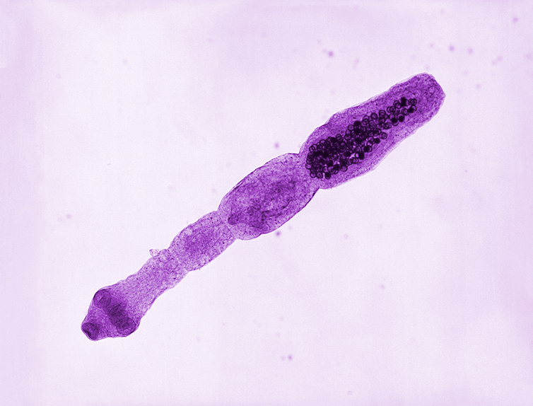 Microphotographie d’un spécimen adulte d’Echinococcus multilocularis